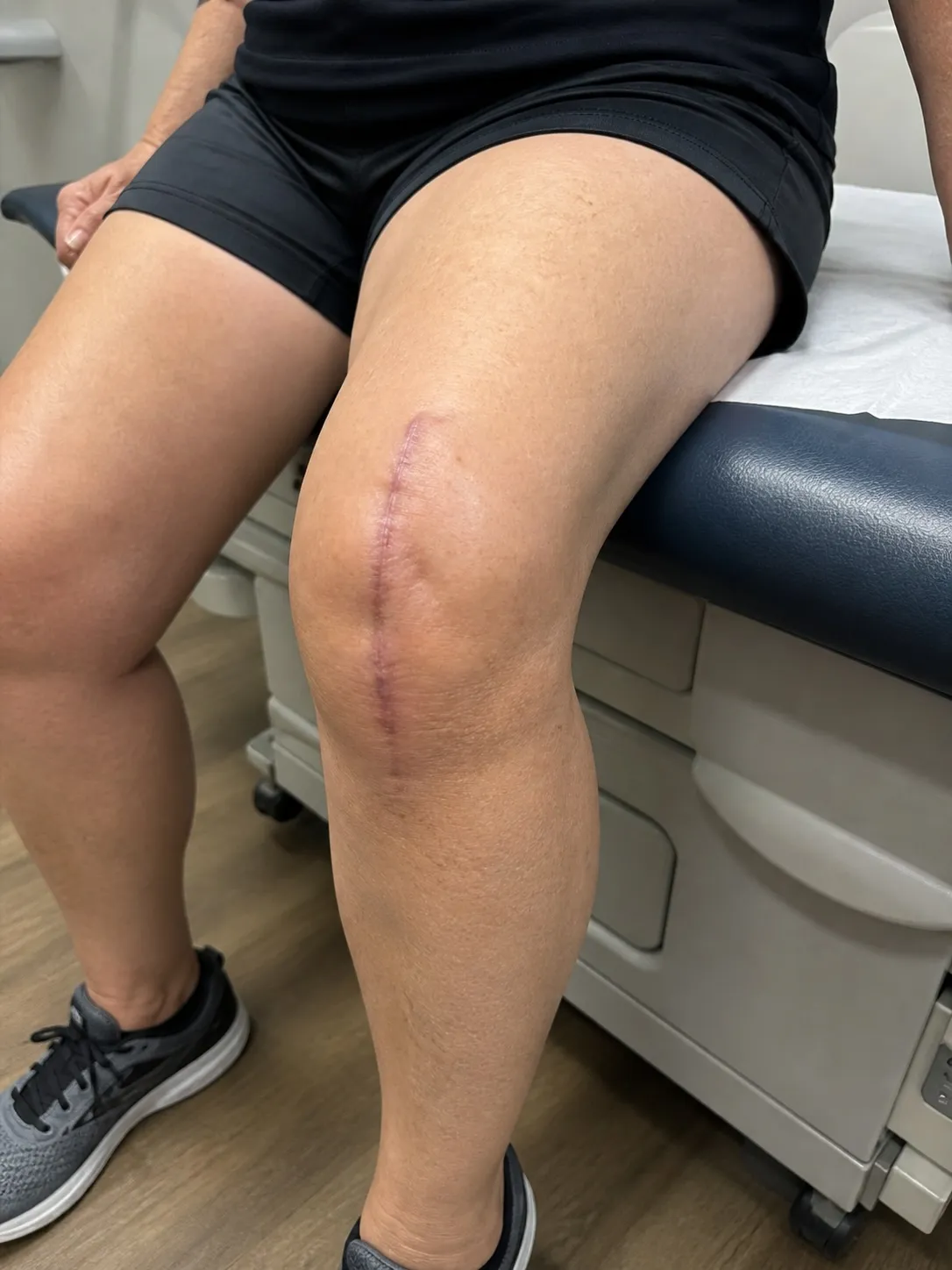 Post-Surgical Rehab